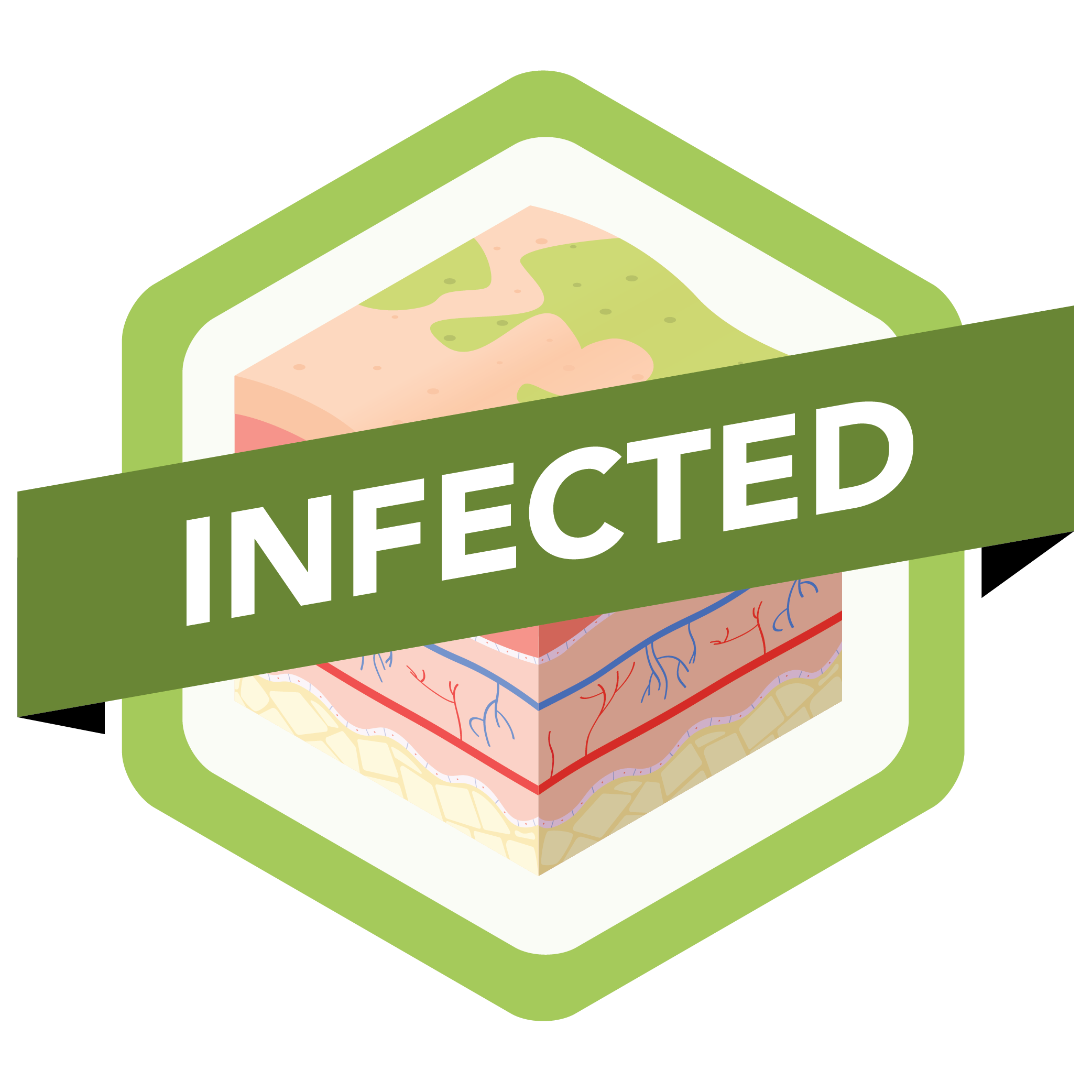 Infected
