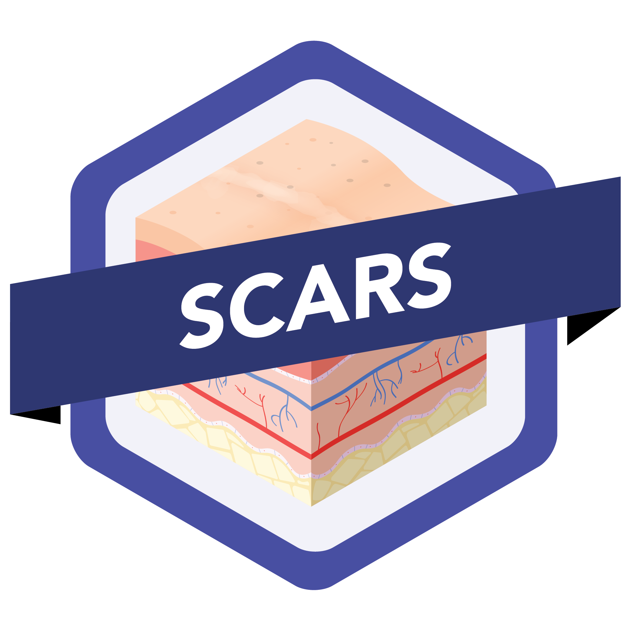 Scars