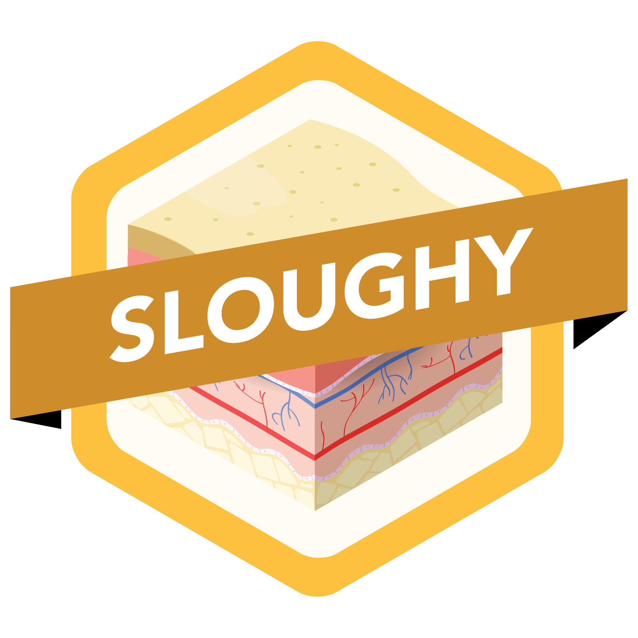 Sloughy